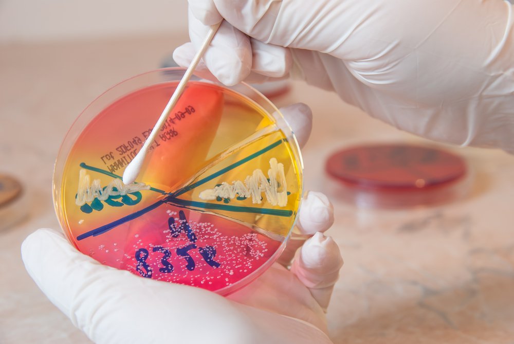 Золотистый стафилококк – что это за бактерия?